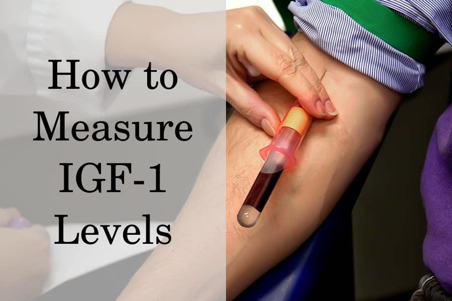 How to Measure IGF-1 Levels